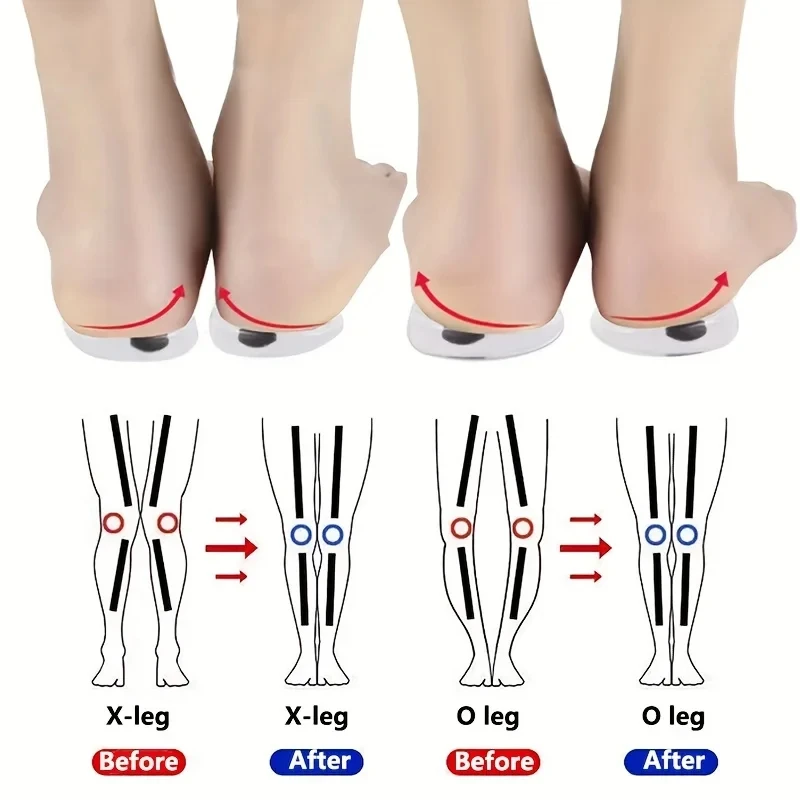 1Pair Orthopedic Insoles for F - Women Shoes Types ulasan dan harga