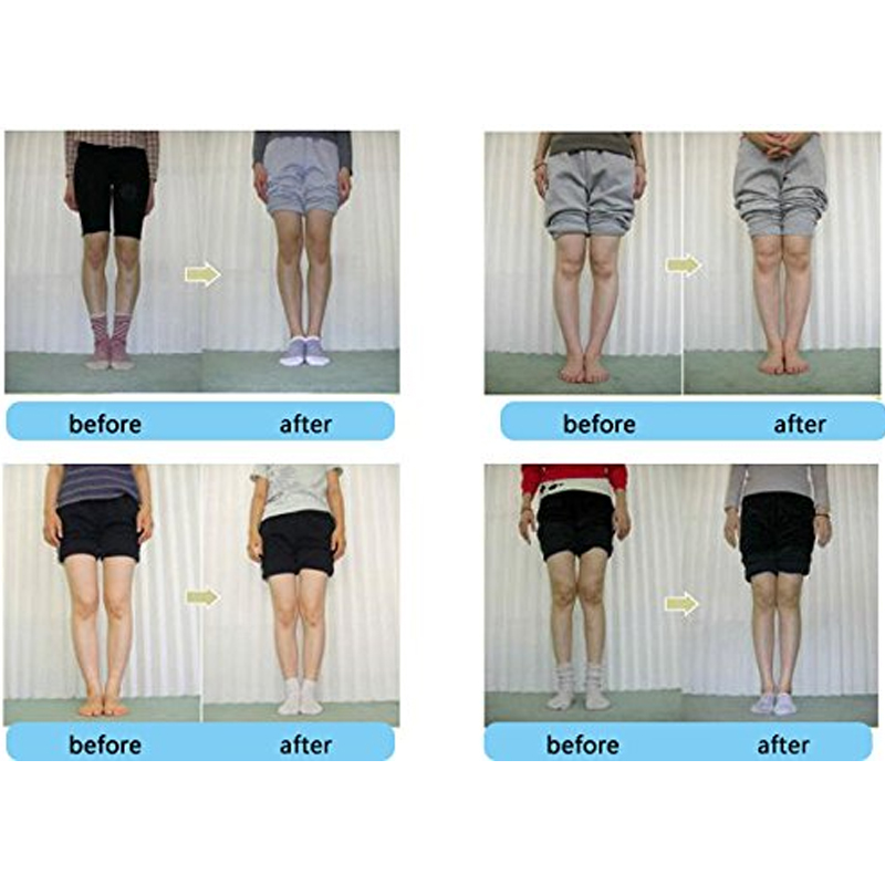 Tcare 1Pair Orthopedic Insoles - Women Shoes Types ulasan dan harga