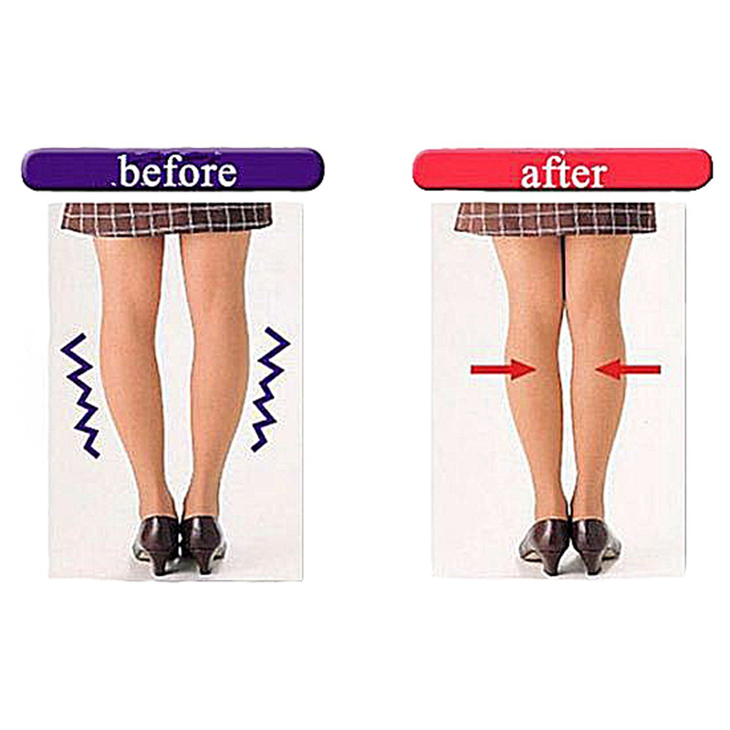 Tcare 1Pair Orthopedic Insoles - Women Shoes Types ulasan dan harga