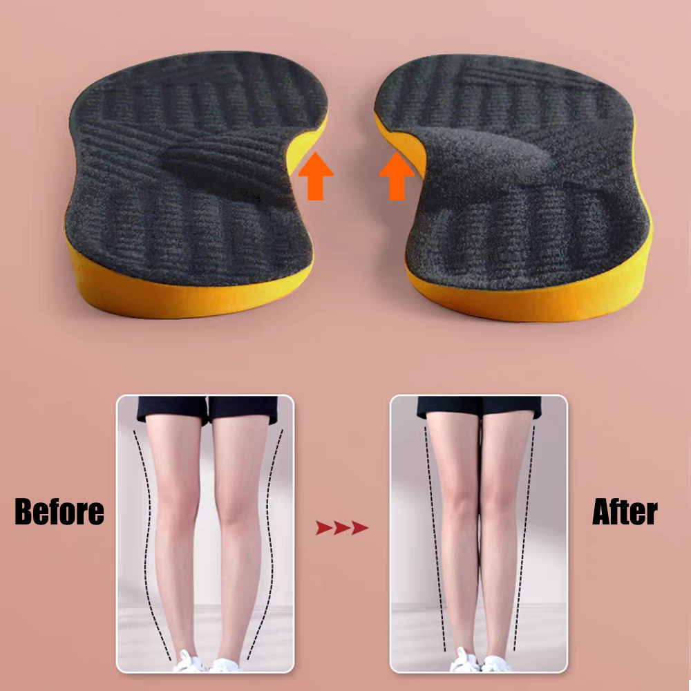 PU Orthotic Insole Arch Suppor - Women Shoes Types ulasan dan harga