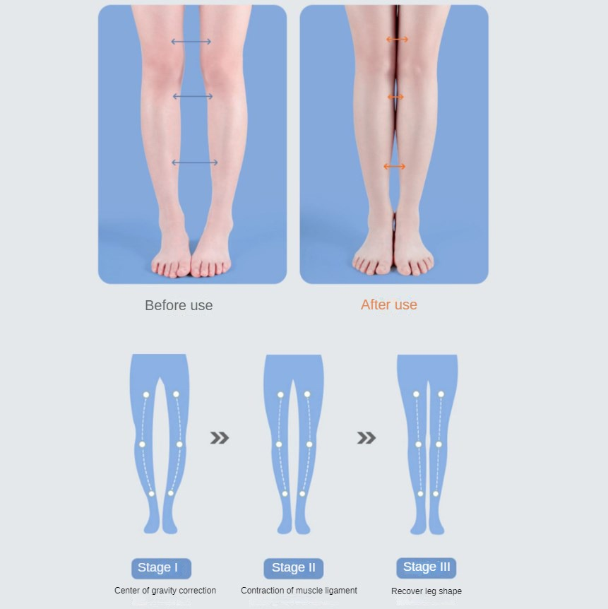 PU Orthotic Insole Arch Suppor - Women Shoes Types ulasan dan harga